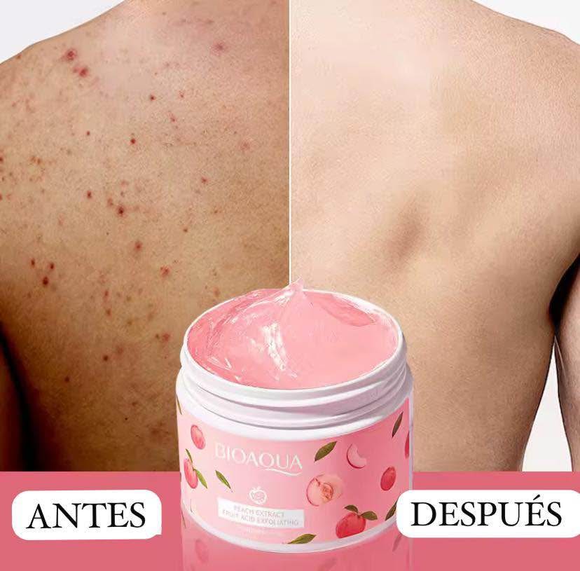 CREMA BLANQUEADORA ACLARANTE DESPIGMENTANTE BIOAQUA