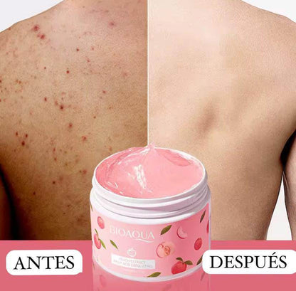 CREMA BLANQUEADORA ACLARANTE DESPIGMENTANTE BIOAQUA